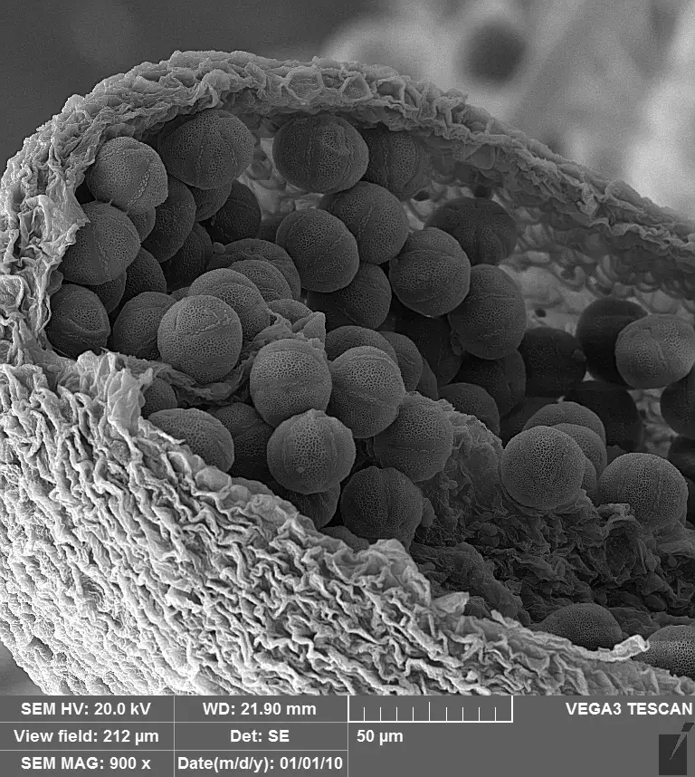 SEM Images Kidney with Vac Coat SEM Coater