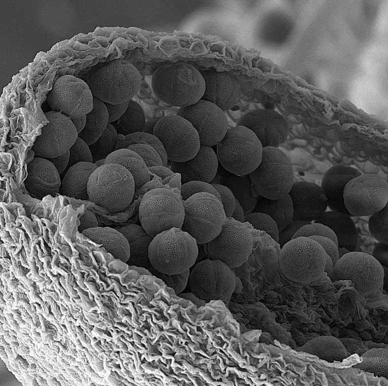 Kidney SEM Image with Vac Coat
